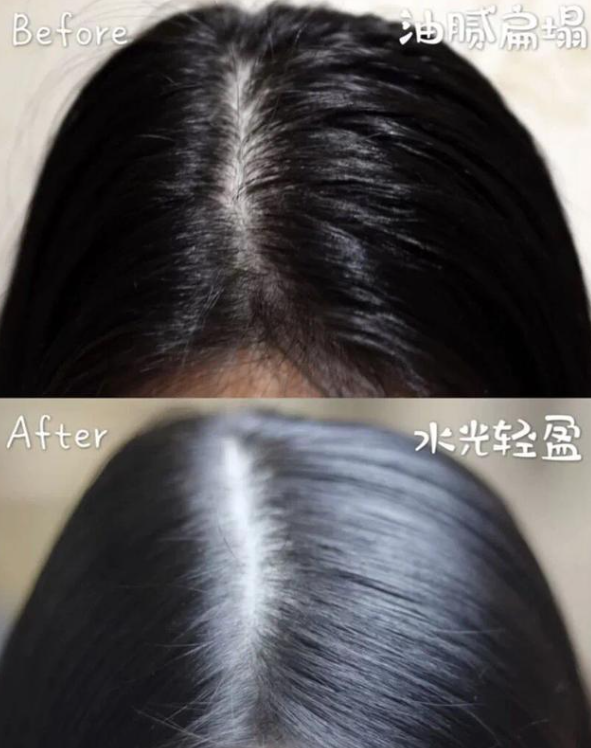 哪种去屑洗发水好？?